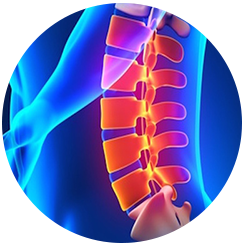 Chiropractor for Herniated Disc