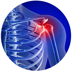 Chiropractor for Rotator Cuff Injuries